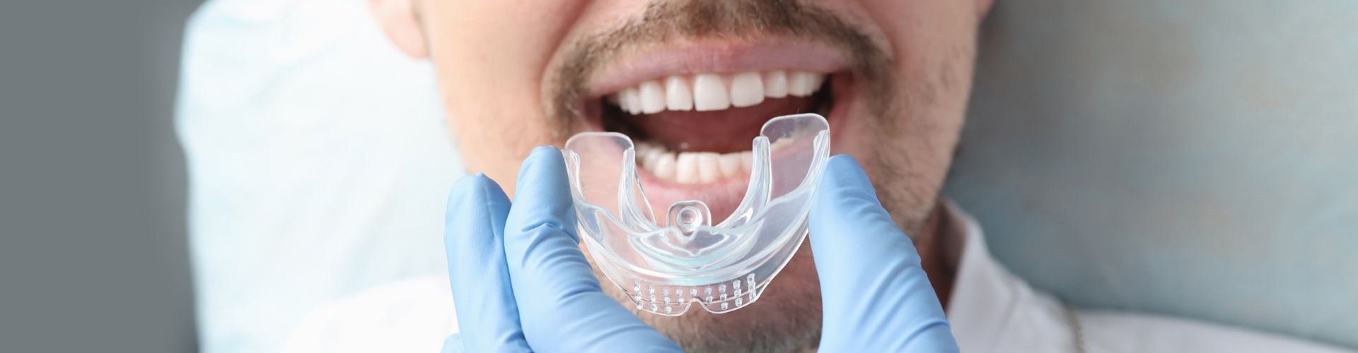 Mouthguards for A Healthy Oral Cavity