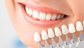 Can Veneers Fix Crooked Teeth?