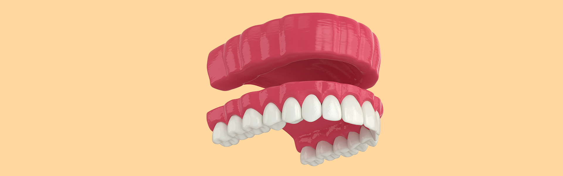 5 Things To Know Before Considering a Dental Bridge