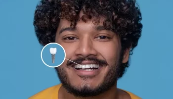 What Happens If You Don’t Replace Missing Teeth? Why Dental Implants Matter